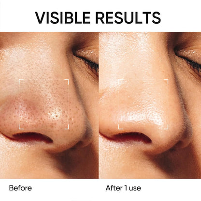 Deep Pore Cleansing Blackhead Remover Face Mask Stick